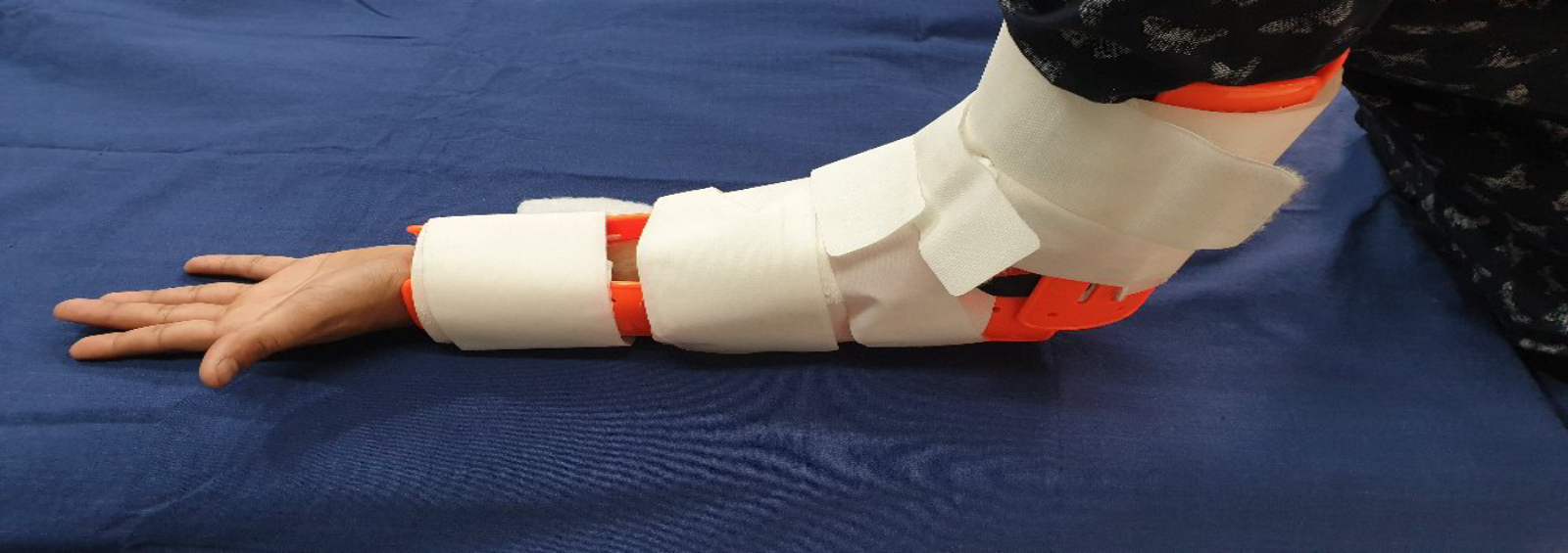 universal-emergency-splint-uem-splint-